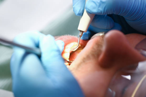 Best Weekend Emergency Dentist in Vicksburg, MI