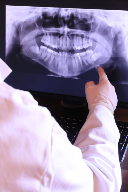Best Emergency Root Canal Treatment in Vicksburg, MI