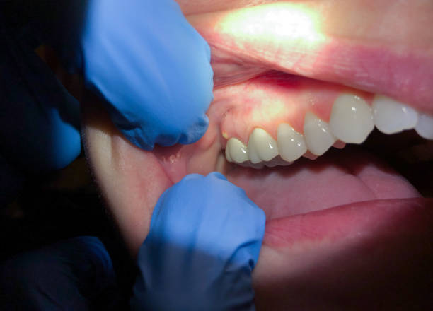 Best Broken or Cracked Tooth Emergency Dentist in Vicksburg, MI