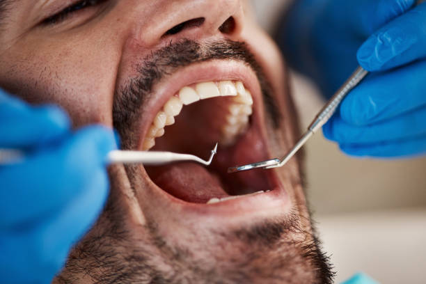 Best Urgent Dental Care for Toothache in Vicksburg, MI