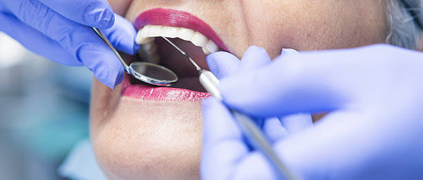 Best Emergency Dentist for Knocked-Out Tooth in Vicksburg, MI